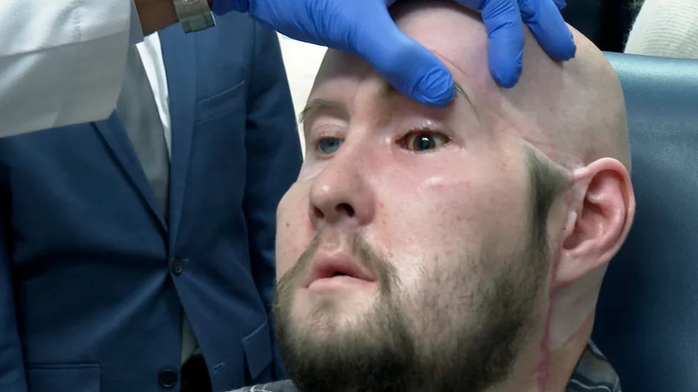 Patienten Aaron James operation genomfördes i maj. Arkivbild.
