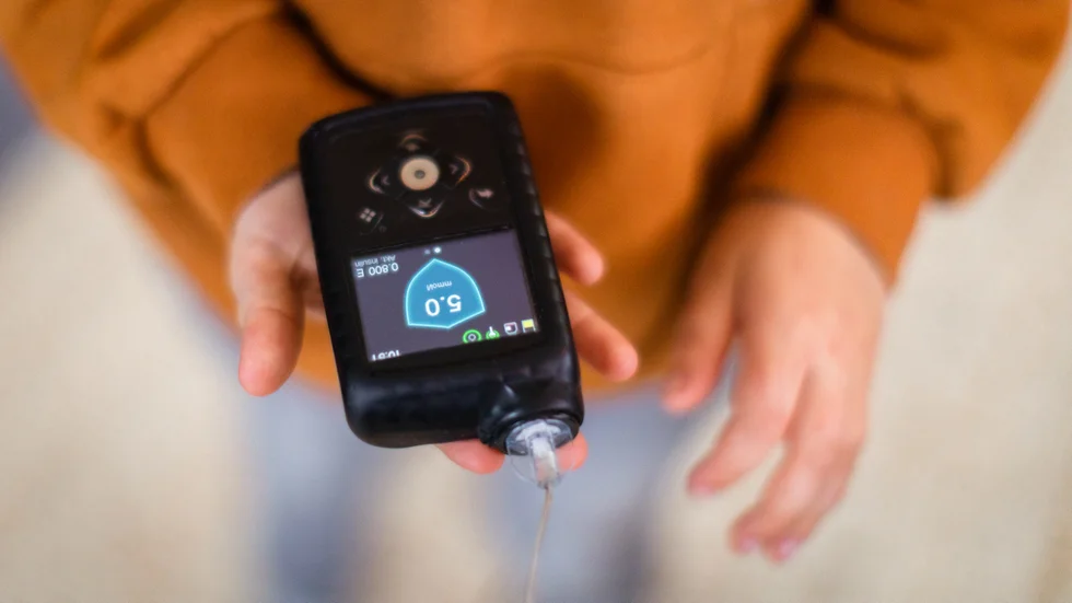 "Nära två av tre med diabetes typ 1 i åldern 15-30 år upplever att deras mående påverkas negativt av sjukdomen. Samma andel är oroliga för hur deras diabetes ska påverka hälsan i framtiden", skriver Clara Bengtsson, påverkansansvarig inom Ung Diabetes. (Arkivbild)