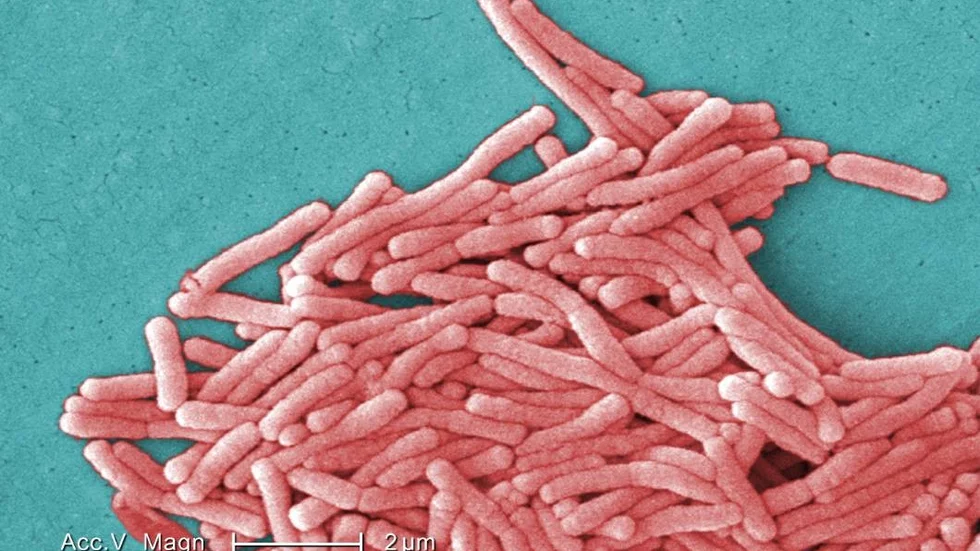 Legionella ser ut så här.