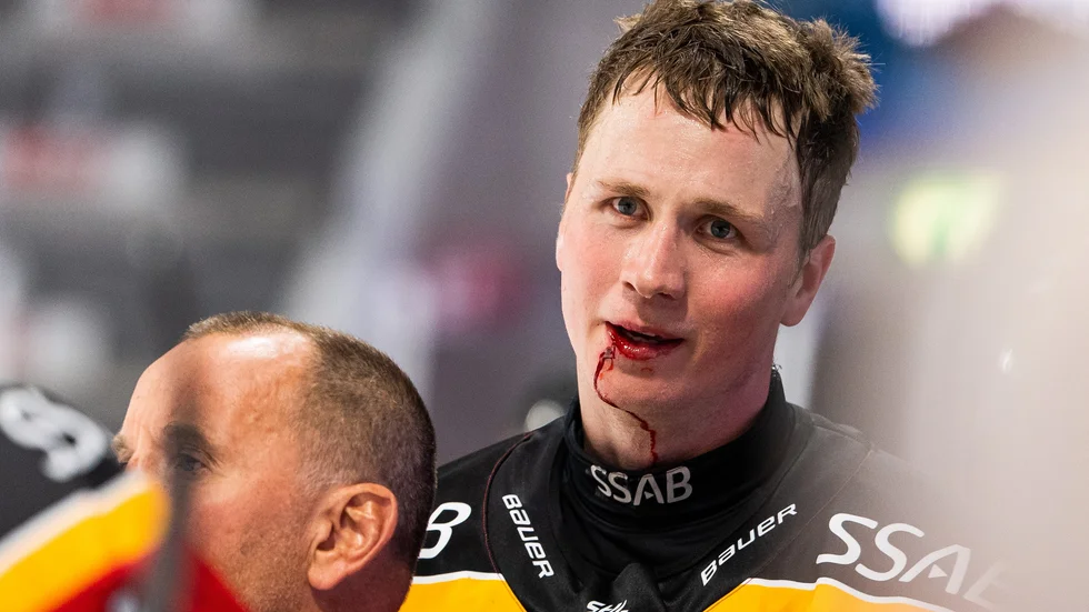 Jonas Berglund tvingades att sy under matchen mot Linköping.  