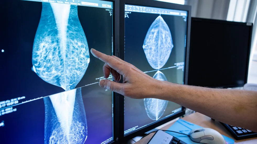 Bristen på röntgenläkare äventyrar bröstcancerscreeningen. Nu måste Region Sörmland förbereda införande av AI-stöd i verksamheten, skriver Bröstcancerförbundet tillsammans med ledande AI-forskare.