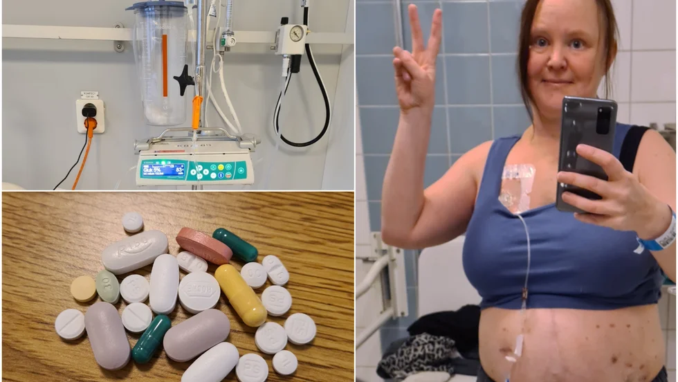 Josefine fick sockerlösningsdropp när hon fastade. Det går åt en hel del medicin: smärtlindring, blodtrycksmedicin, immunsupprimerande (för att kroppen inte ska stöta bort njuren), kortison, blodförtunnande och insulin (blodockret kan höjas när man äter kortison). Porträttet tog Josefine dag 15, strax innan hon åkte hem.