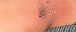 Pappans skräck: "Hunden attackerade min dotter"