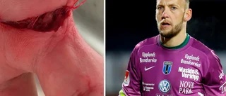 Siriusmålvaktens märkliga skada