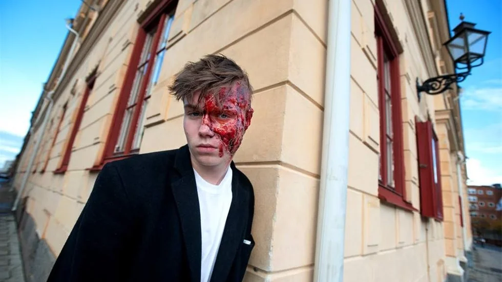 Inspirationen till Halloween-sminkningen var karaktären Two-Face i Batman. Här står en brännskadad Otto Plesner utanför Arbis.