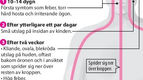 Viruset sprids via små droppar i utandningsluften.