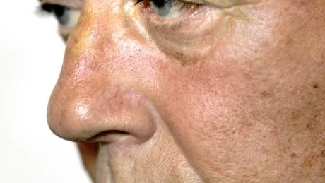 Bernt-Ove Hemmander.