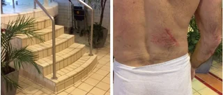 Halkade på Fyrishov – bröt tre revben