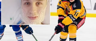 Jonas Berglunds väg tillbaka efter operationen