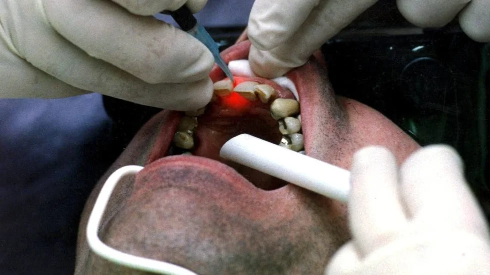 Muntorr. Personer som är muntorra kan behöva regelbunden behandling en av tandhygienist.