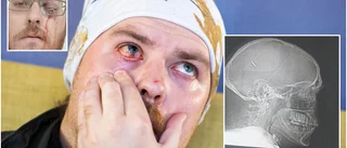 På ett ögonblick förändrades livet för Michael, 38