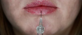 Ville ha "russian lips" – fick förstörda klumpläppar