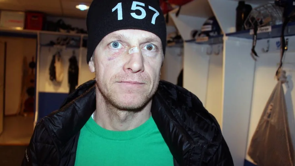 ÄRRAD. Patrik Spångberg är märkt av många års elitidrottande på is. Nu ska bandyveteranen reparera näsan för tredje gången.