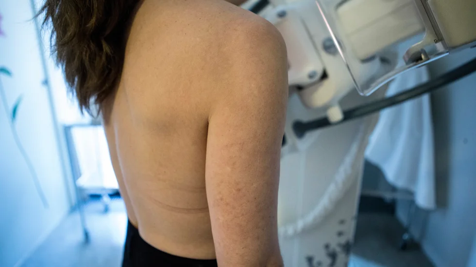 Skillnaderna kring hur många som går på screening för bröstcancer och livmoderhalscancer skiljer sig åt beroende på var i landet man bor. Arkivbild.
