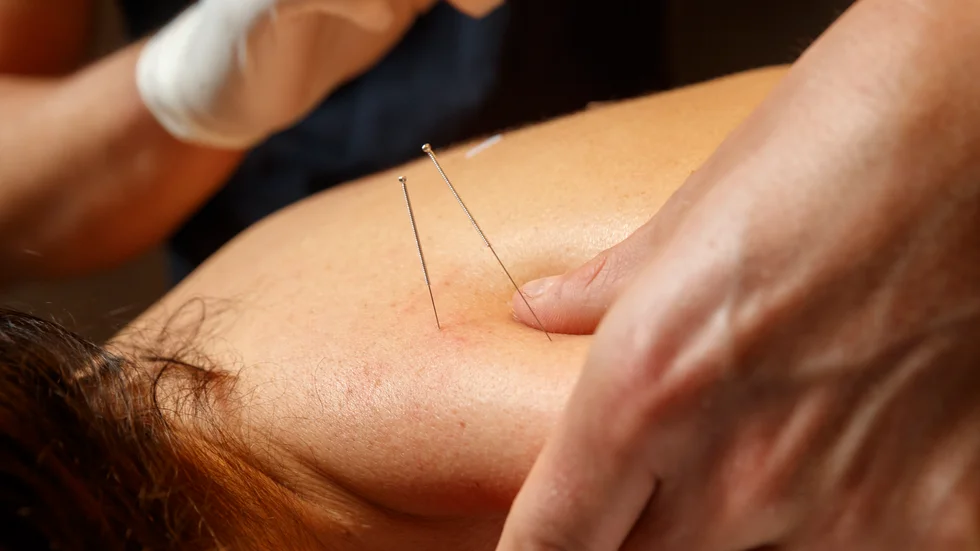 Var fjärde patient med cancer använder alternativa metoder för att må bättre. Men det är ovanligt att man berättar om det för sjukvården visar forskning. Arkivbild.