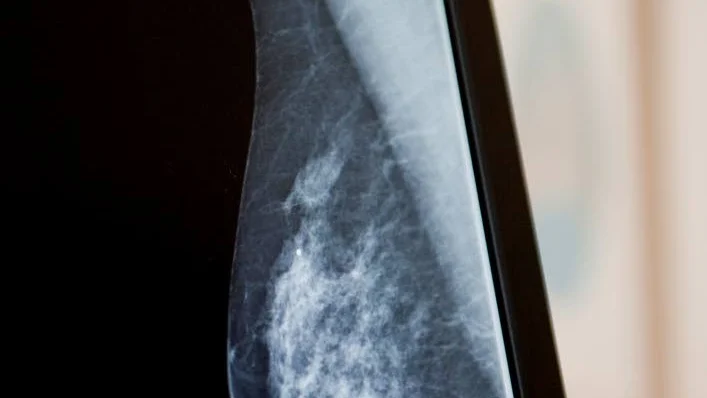Mammografi görs för att upptäcka bröstcancer.
