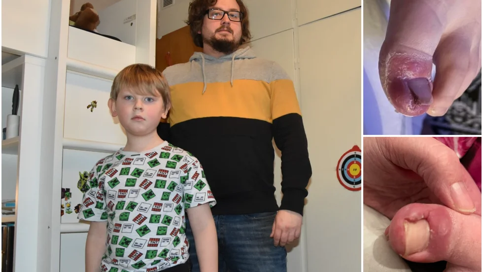 De enda skor som går att använda är de allra rymligaste vinterskorna.