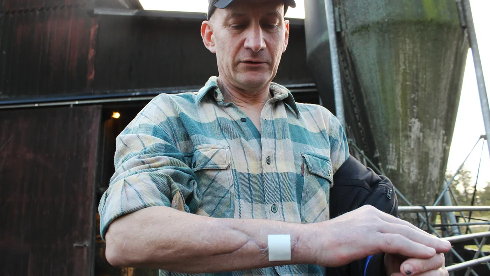 Armen var av på två ställen, alla senor var av. Idag börjar rörligheten komma tillbaka i Christer Karlssons hand, även om det är långt kvar till att han är helt återställd. Han hoppas kunna börja jobba igen, snart.