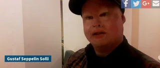 Se: Här berättar han om kalkolyckan