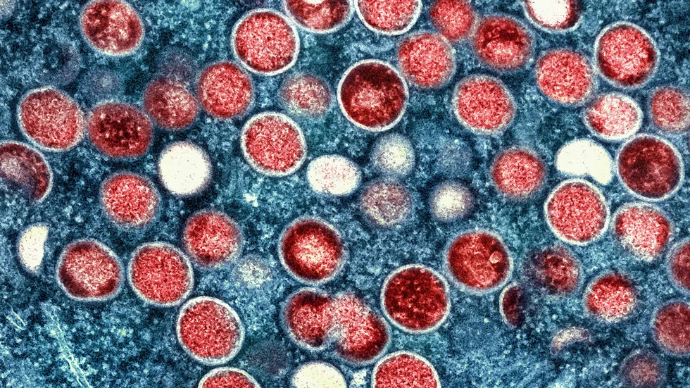 Lika obehagligt som coronaviruset, men mpox är ändå ett mindre hot. Än så länge.