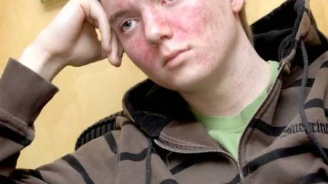ALLT SVART. "Jag orkade skrika två gånger, sedan blev allt svart", berättar Oscar Englund om den otäcka upplevelsen när skyddstaket gav vika.