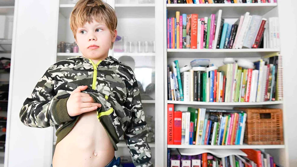 Viktor visar var pacemakern sitter; på hans vänstra sida.