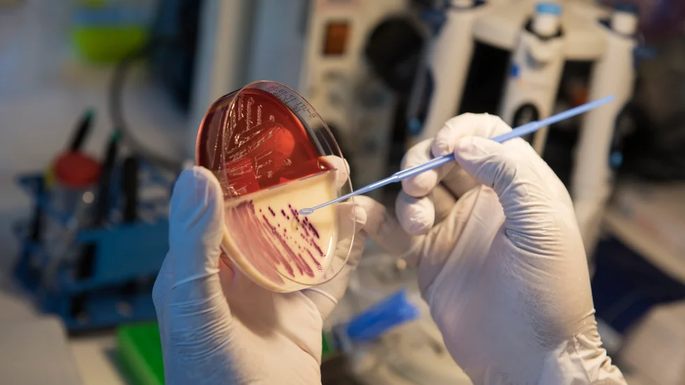 ESBL-Carba är en multiresistent bakterie som få antibiotika biter på. Bilden visar en odling av resistenta bakterier vid ett sjukhus.