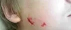 Hund gick till attack
