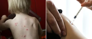 Regionstyrelsen säger nej till vattkoppsvaccin
