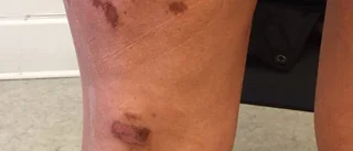 Nyårsvandringen blev en mardröm