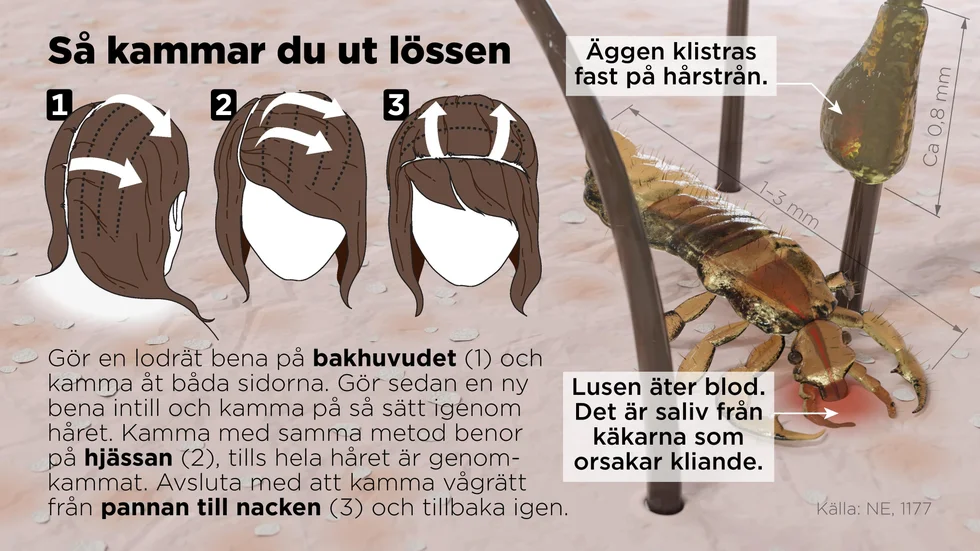 Använd en luskam för att kamma ut löss och gnetter ur håret.