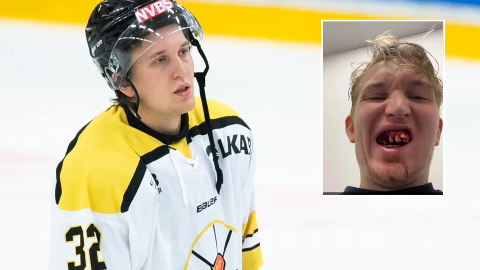 Kiruna AIF:s Ville Erixon åkte på en riktig käftsmäll mot Sundsvall i söndags.