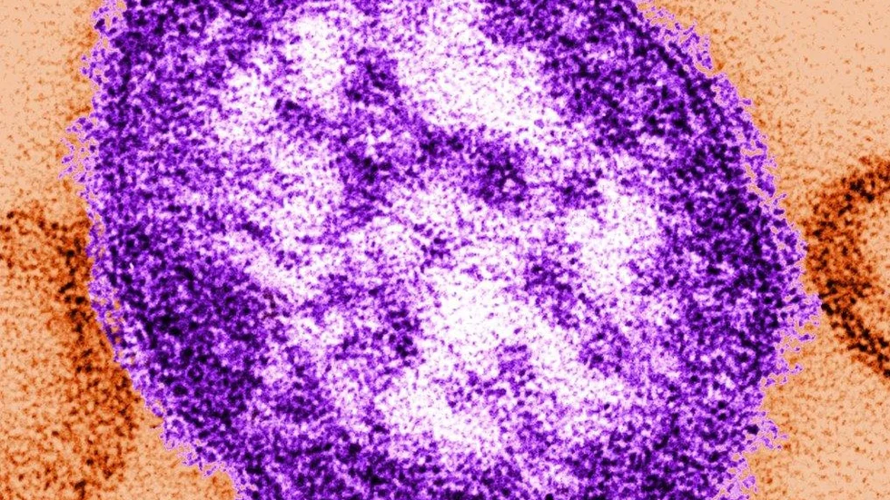 Mässling orsakas av ett extremt smittsamt virus.