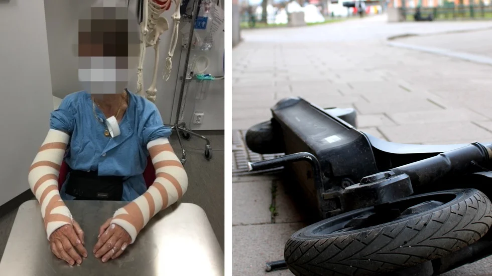 "Jag uppmanar alla fotgängare att vara försiktiga", säger kvinnan som bröt båda armbågarna när hon snavade över en slarvigt parkerad elsparkcykel.