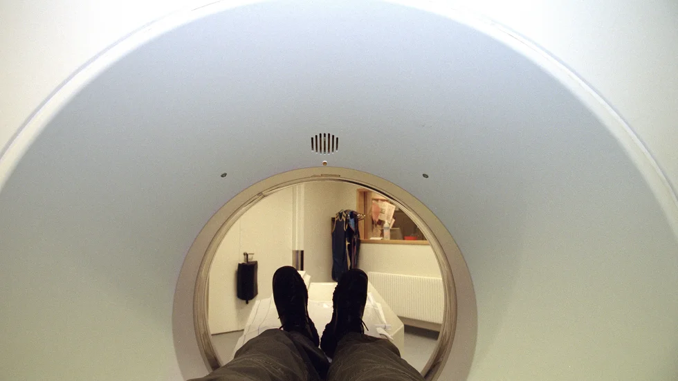 En datortomografi visade att patienten hade en allvarlig hjärnskada.