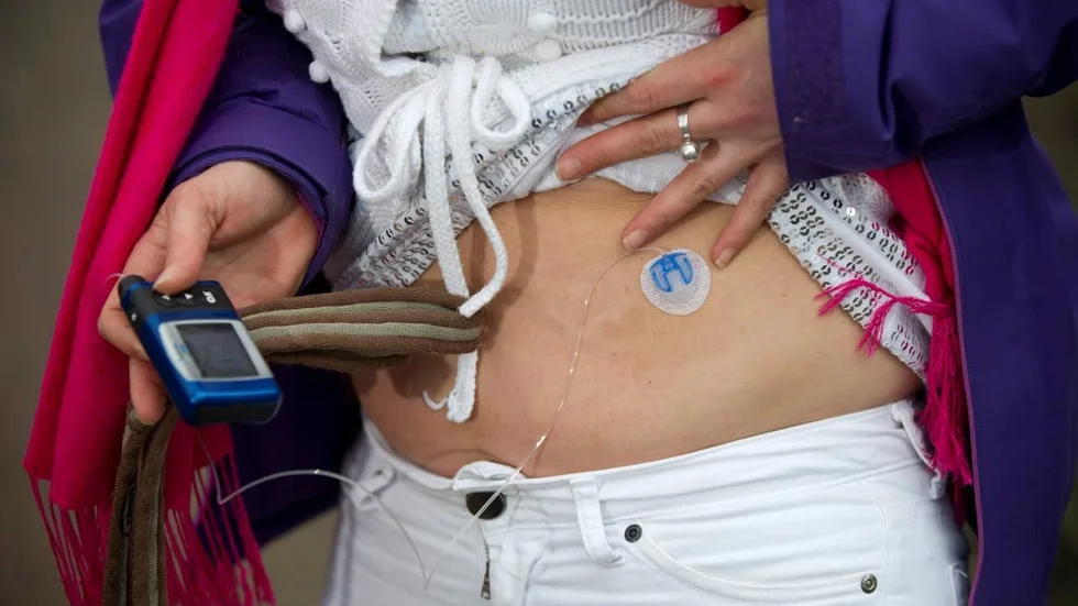 Typ 1-diabetes drabbar många svenskar.