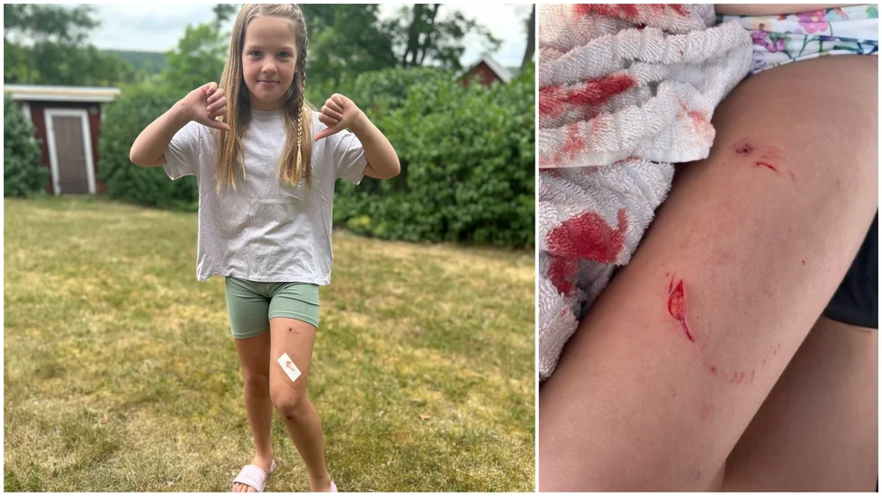 Mathilda Ringdahl, sju år, blev biten av en gädda när hon badade med familjen under torsdagen. "Varför hände det just mig?", undrar hon.