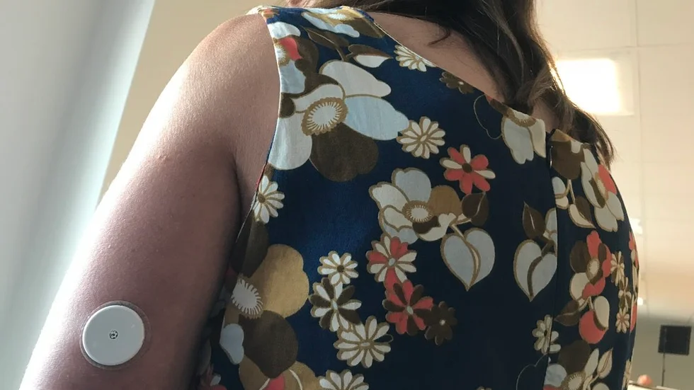 "Dosan är en liten sensor och jag har den för att jag har diabetes typ 1. Dosan har en fisklinetunn sensor som skjuts in i kroppsvävnaden och sitter där dygnet runt. Genom elektronik kan jag läsa av den med mobilen och få svar hur det ser ut med blodsockret", berättar Marie Hillblom i sin krönika.
