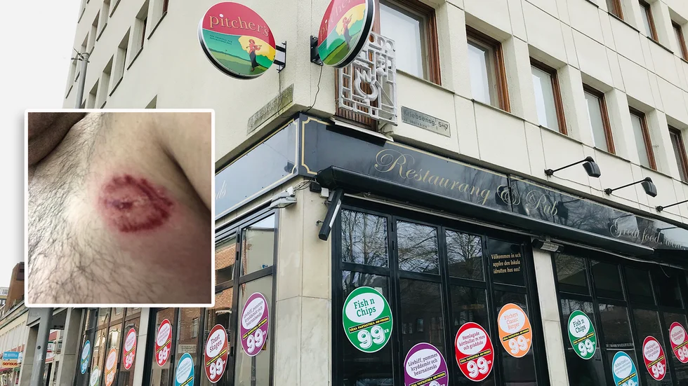 Händelsen på Pitchers i Eskilstuna rubriceras som misshandel. Den utsatte entrévärden, som vill förbli anonym, tvingades uppsöka sjukhus efter bitattacken.