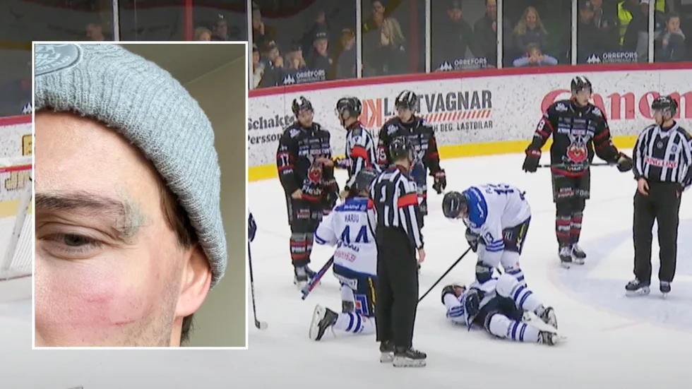 Davis Lilja tvingades utgå i söndagens match efter ha träffats illa vid ögat efter ett slagskott från en lagkompis i Bik Karlskoga. 