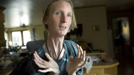 Ann-Sofi Klint kan bara öppna munnen någon millimeter. Hon fick diagnosen FOP när hon var 1,5 år. I Sverige finns det cirka tio personer som har sjukdomen. Familjen Klint känner dem alla vid namn.                      FOTO: Kurt Engström