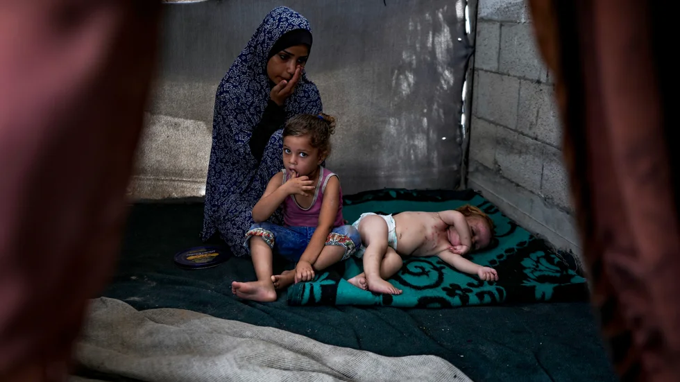 Manar al-Hussi i sitt provisoriska hem i ett läger i Dayr al-Balah i centrala Gaza den 29 juli. Hennes barn lider av hudproblem orsakade av de sanitära förhållandena i lägret.
