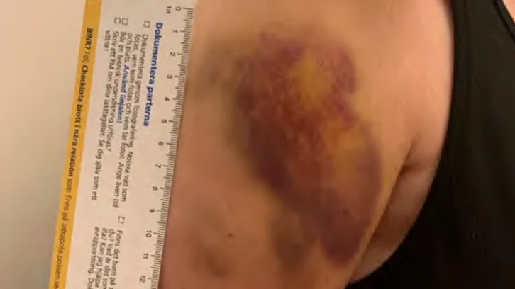 Kvinnan i 50-årsåldern hade skador på stora delar av kroppen som orsakats av våld. (Arkivbild)