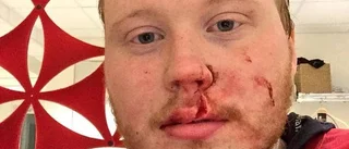 Fick sy 19 stygn – efter kvalmatchen