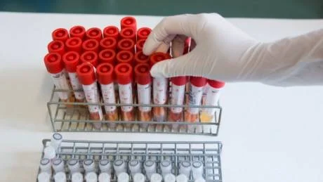 OSLO 20090720:
Mikrobiologisk laboratorium ved Ullevål Sykehus
der en tar tester av virus A (H1N1), bedre kjent som svineinfluensa
Foto: Berit Roald / SCANPIX NORGE / SCANPIX / kod  20520