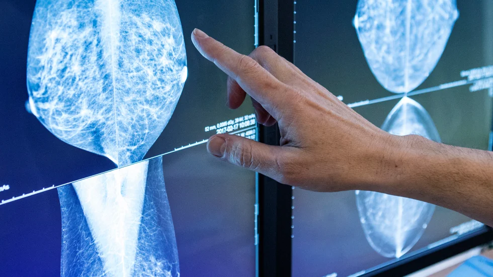 "Det finns tumörer som har de här egenskaperna – magsäckscancer, lungcancer och urinblåsecancer till exempel – där det också finns patienter som kommer att ha nytta av det här", säger Henrik Lindman, t.f verksamhetschef för blod- och tumörsjukdomar på Akademiska sjukhuset.