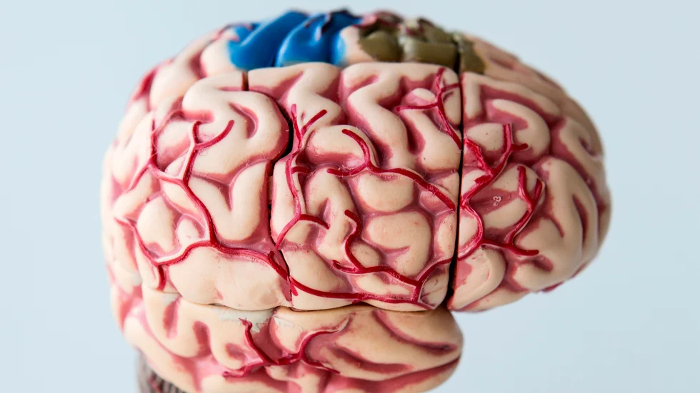Antalet svenskar som drabbas av stroke fortsätter att minska.