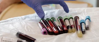 Hoppfullt för experimentell cancerbehandling