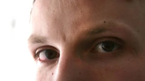 Röda ögon? Har du sovit för lite? Det kan vara en orsak.