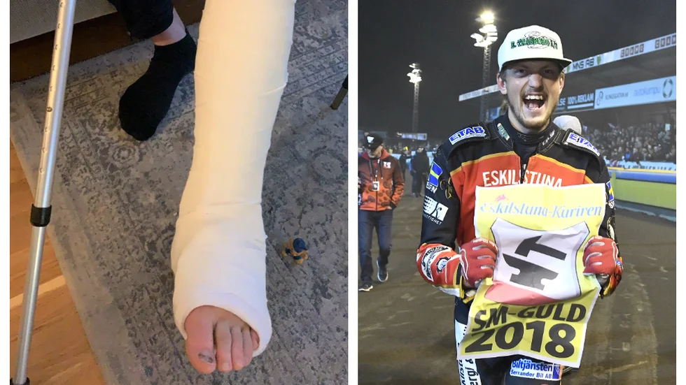 Linus Eklöf, som vann tre raka SM-guld med Smederna, går gipsad efter att har brutit fotleden på två ställen.